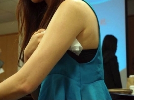 怎么鉴别狐臭这种疾病呢